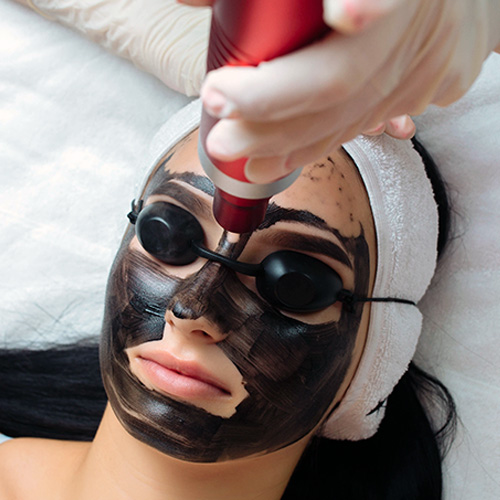 closeup-cosmetologists-hand-making-hardware-carbon-peeling-by-young-pretty-customer-woman-safe